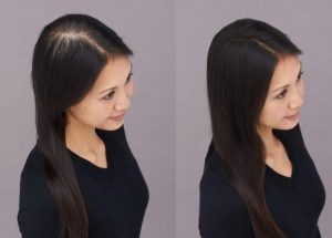 Tricopigmentazione donna capelli lunghi
